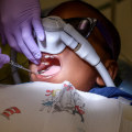 What Kind of Anesthesia is Used for Pediatric Dentistry?